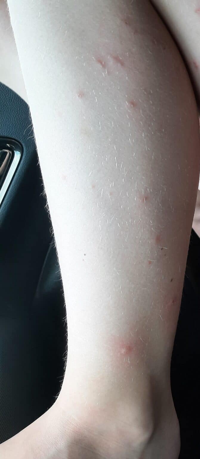 Dealing With Gypsy Moths in Greater Toronto Area Gypsy Moth Control